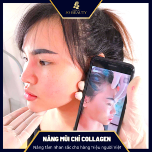 nang-mui-chi-collagen